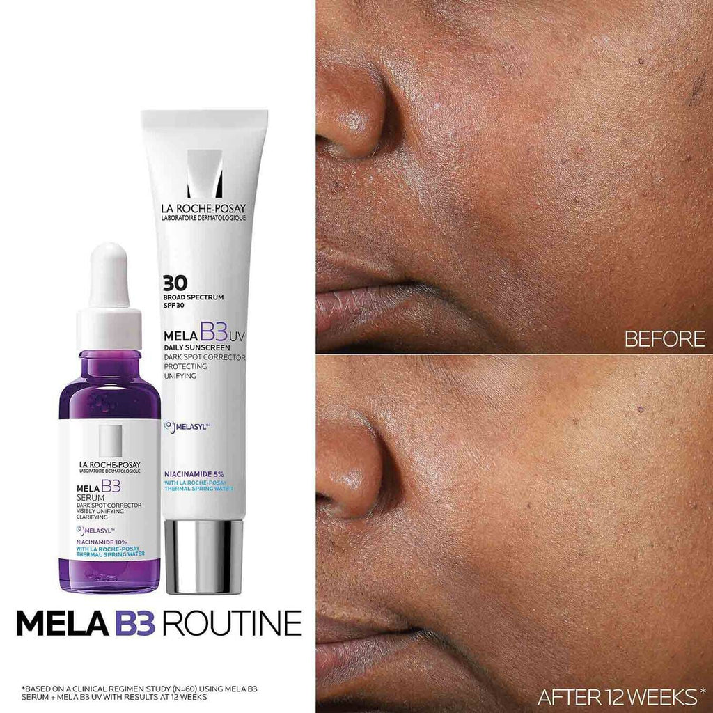 Mela B3 Dark Spot Serum & Mela B3 UV Daily Moisturizer With SPF 30