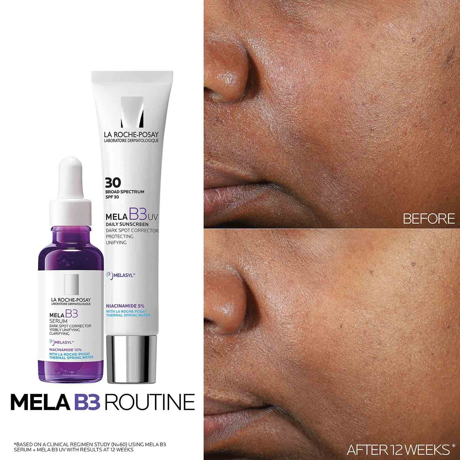 Mela B3 UV Daily Moisturizer SPF 30 With Melasyl™ + Niacinamide